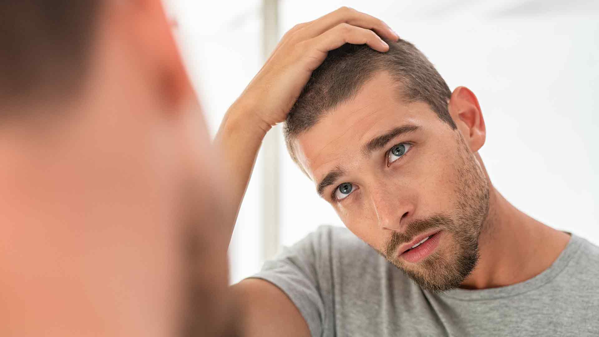 Alopécie chez les hommes