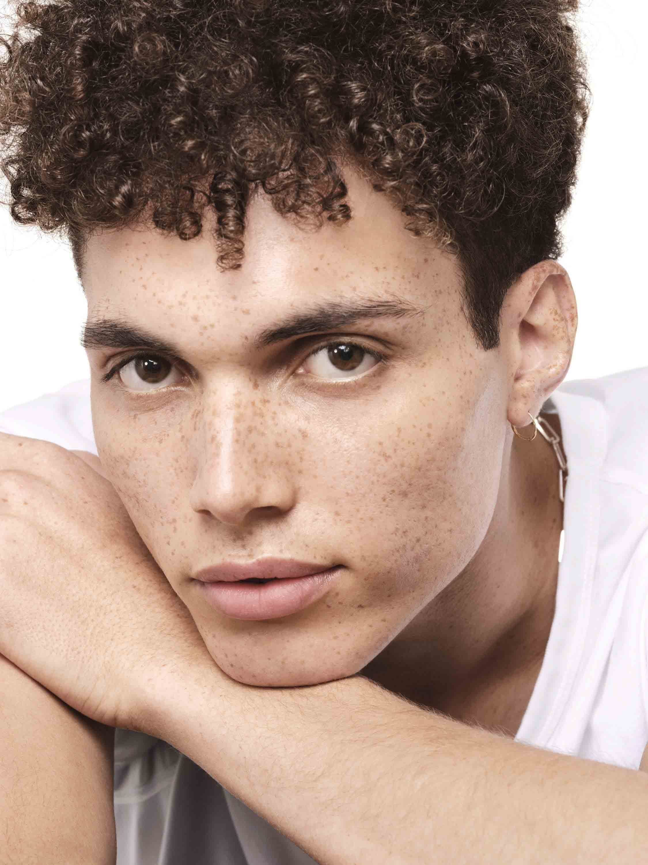 Nahaufnahme eines Mannes mit Sommersprossen legt den Kopf auf die Arme und blickt in die Kamera Fokus auf Gesichtshaut