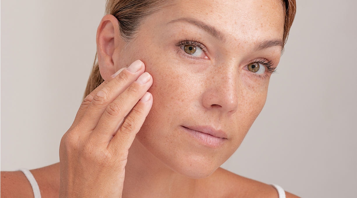  Eine Frau mit Sommersprossen blickt freundlich in die Kamera.