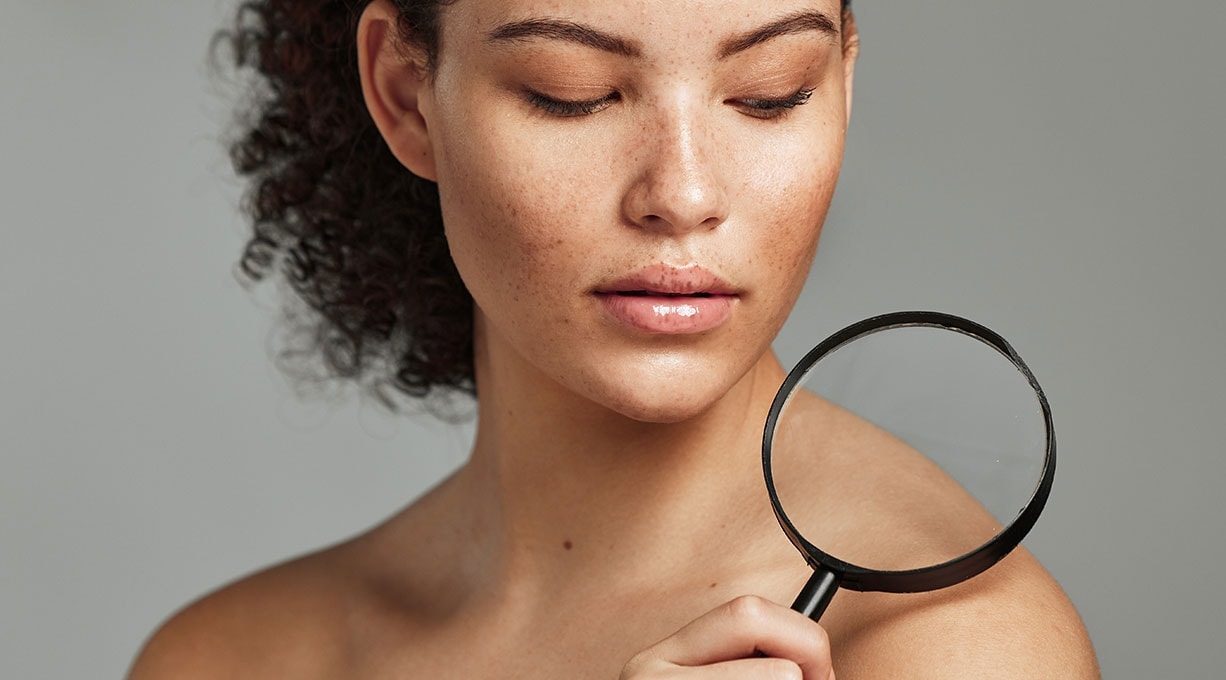 Nahaufnahme eines Gesichts mit vereinzelten Pigmentflecken, Finger deutet auf die Haut