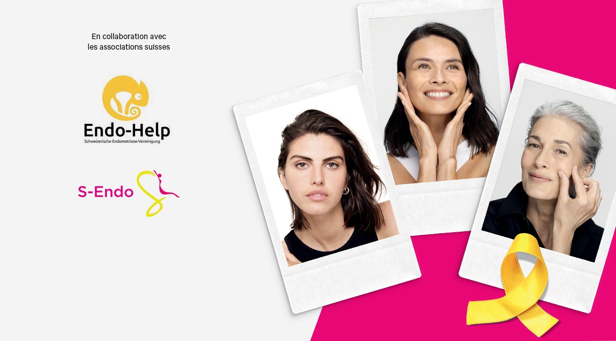 Trois femmes de différents âges avec un ruban jaune, symbole de sensibilisation à l’endométriose.
