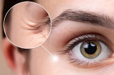 Nahaufnahme einer weiblichen Augenpartie, in der die kleinen Fältchen am Auge im Fokus stehen