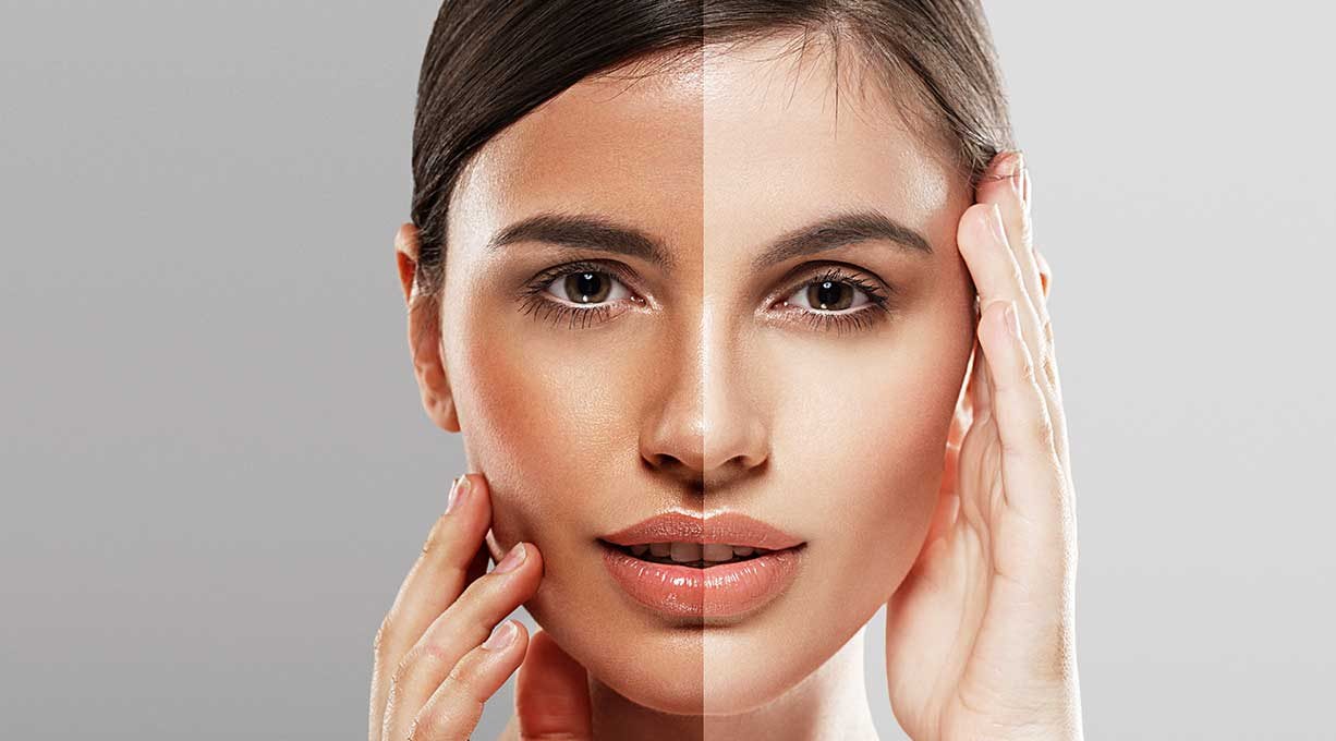 Gesicht einer Frau, eine Hälte ist gebräunt, die andere Hälfte ist blass