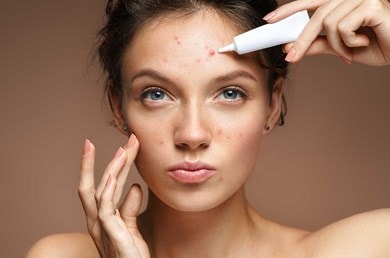 Eine junge Frau mit Akne trägt Make-Up im Gesicht auf um ihre Unreinheiten zu verdecken