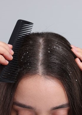 Femme avec des pellicules se peignant les cheveux