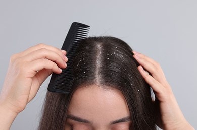 Femme avec des pellicules se peignant les cheveux