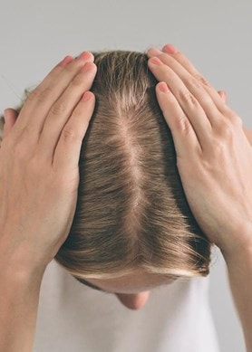 Frau hält sich mit beiden Händen den Kopf; der Scheitel weist auf Haarverlust hin