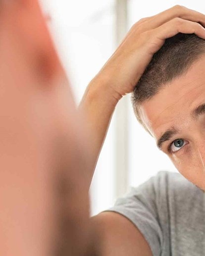 Alopécie chez les hommes