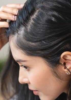 Eine Frau betrachtet ihren Haaransatz im Spiegel