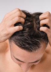 Mann mit dunklen Haaren von oben, der mit den Fingerspitzen seine Kopfhaut kratzt