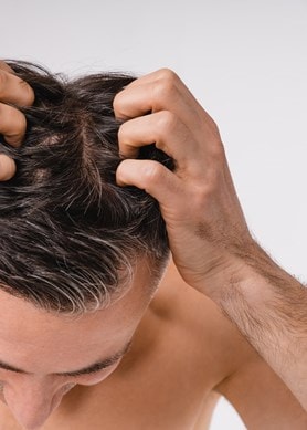 Mann mit dunklen Haaren von oben, der mit den Fingerspitzen seine Kopfhaut kratzt