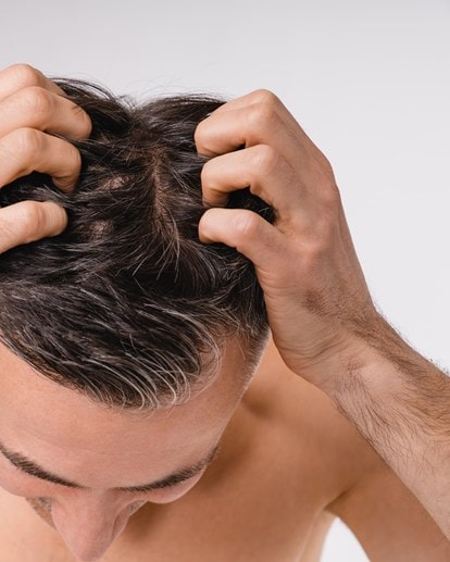 Mann mit dunklen Haaren von oben, der mit den Fingerspitzen seine Kopfhaut kratzt