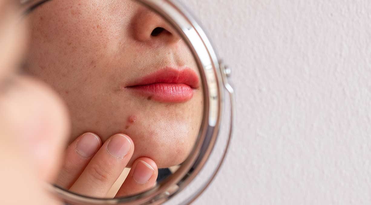 Anwendung Niacinamide