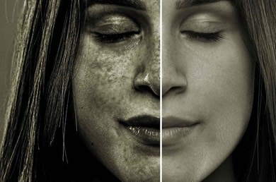 Sonnenschutz und AntiAging