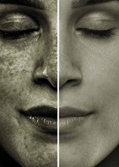Une comparaison entre le côté gauche du visage, visiblement abîmé par le soleil et couvert de taches, et le côté droit, qui semble plus lisse et plus sain, sur fond neutre.