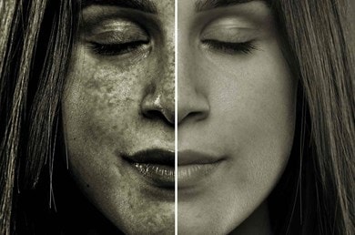 Une comparaison entre le côté gauche du visage, visiblement abîmé par le soleil et couvert de taches, et le côté droit, qui semble plus lisse et plus sain, sur fond neutre.