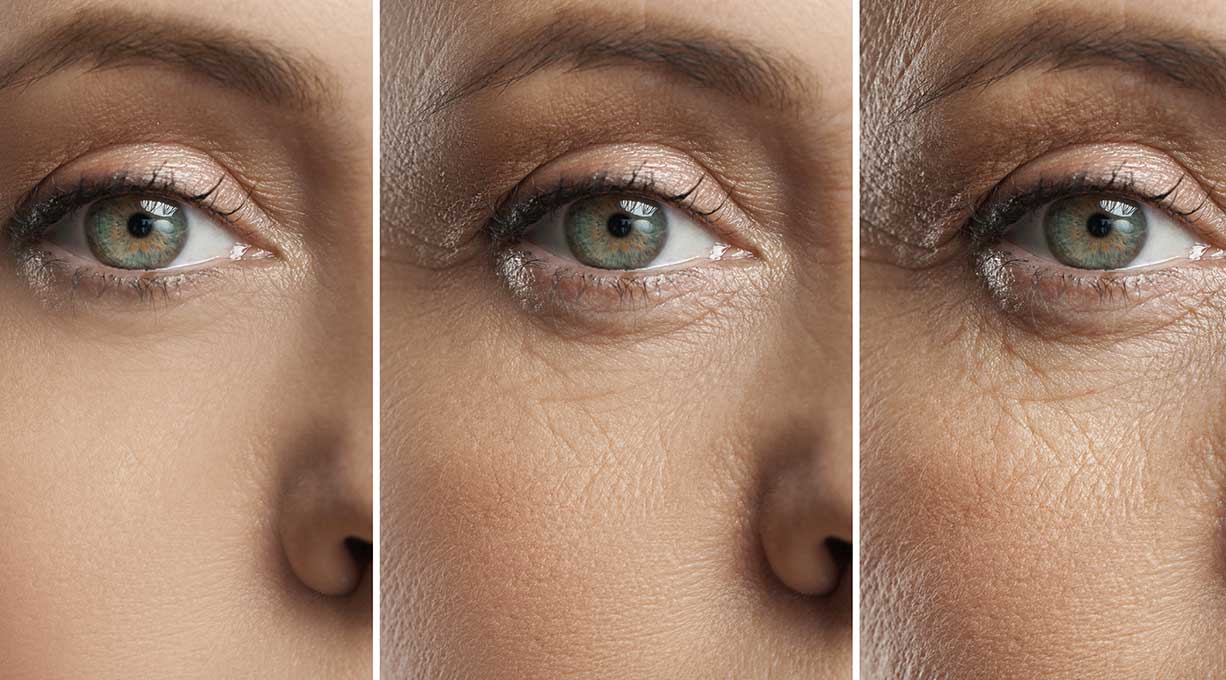 Drei Bildausschnitte derselben Augenpartie, um die Entstehung von Falten zu zeigen. 