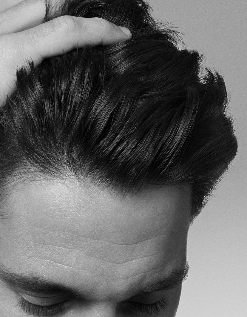 Zone frontale supérieure avec transition vers les cheveux.