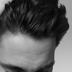 Zone frontale supérieure avec transition vers les cheveux.