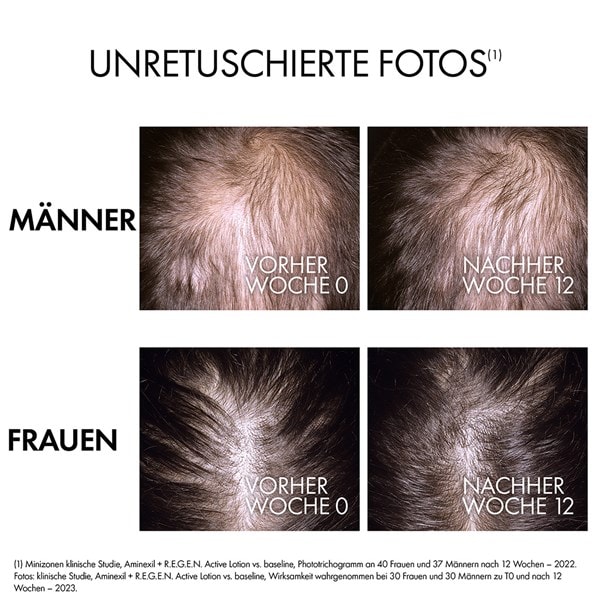 Nach 12 Wochen Anwendung erkennt man bei Frauen und Männern die Wirksamkeit des Serums
