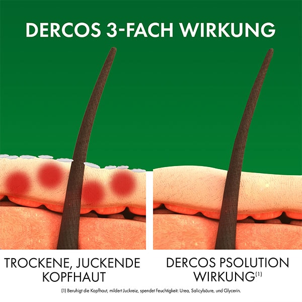 Eine Haarwurzel mit dem Produkthinweis DERCOS PSolution Pflegeshampoo von Vichy gegen trockene juckende Kopfhaut