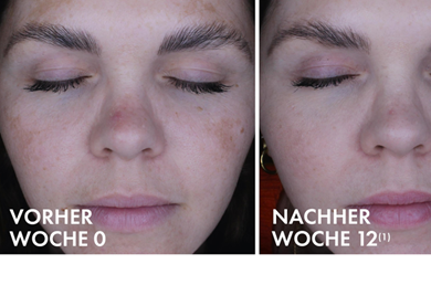 Vichy Liftactiv B3 Anti-Pigmentflecken Nachtcreme