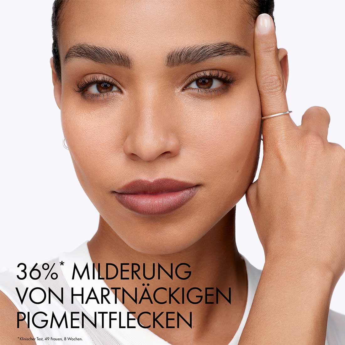 Frau mit ebenmässigem Teint berührt ihre Schläfe, daneben Schriftzug "36 %* Milderung von hartnäckigen Pigmentflecken"