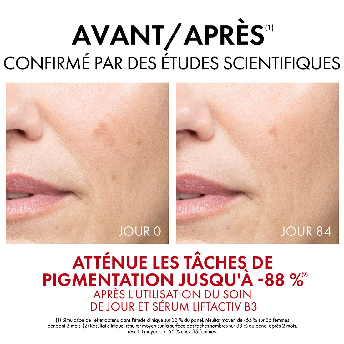 Liftactiv_Pigment_Specialist_B3_Tagescreme_FR_Visual_8