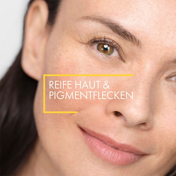 Anwendung der Vichy NEOVADIOL Anti-Pigmentflecken Creme LSF 50 im Gesicht einer Frau mit dem Hinweis auf Pigmentreduzierung